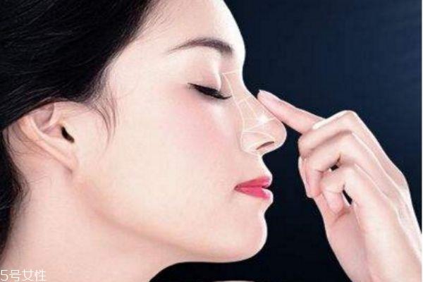 <a href=http://www.mx185.com/listinfo-737-0.html target=_blank class=infotextkey>隆鼻</a>修复安全吗 鼻修复失败案例