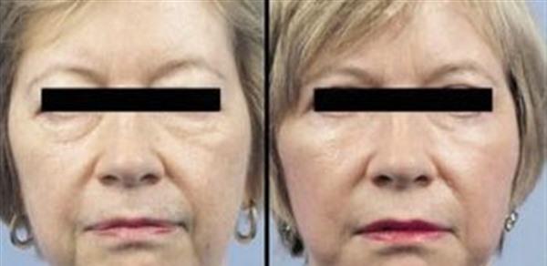 做<a href=http://www.mx185.com/listinfo-613-0.html target=_blank class=infotextkey>射频</a><a href=http://www.mx185.com/listinfo-768-0.html target=_blank class=infotextkey>微针</a><a href=http://www.mx185.com/listinfo-771-0.html target=_blank class=infotextkey>去眉间纹</a>风险有哪些