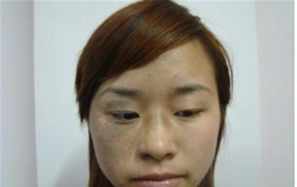 做<a href=http://www.mx185.com/listinfo-799-0.html target=_blank class=infotextkey>去太田痣</a>价格多少钱