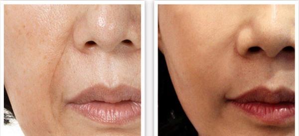 <a href=http://www.mx185.com/listinfo-734-0.html target=_blank class=infotextkey>爱贝芙</a><a href=http://www.mx185.com/listinfo-771-0.html target=_blank class=infotextkey>去眉间纹</a>手术安全吗？