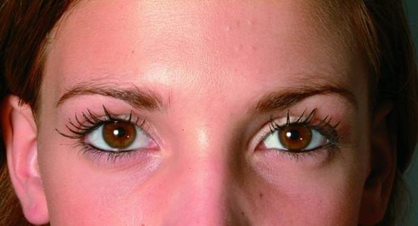 <a href=http://www.mx185.com/listinfo-795-0.html target=_blank class=infotextkey>祛斑</a>危害