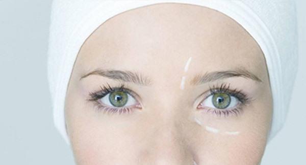 激光<a href=http://www.mx185.com/listinfo-614-0.html target=_blank class=infotextkey>除皱</a>需要多少钱