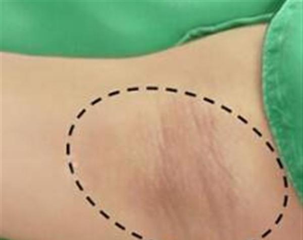 成都<a href=http://www.mx185.com/listinfo-784-0.html target=_blank class=infotextkey>去狐臭</a>价格