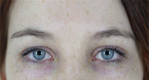 激光<a href=http://www.mx185.com/listinfo-786-0.html target=_blank class=infotextkey>去黄褐斑</a>有危害吗