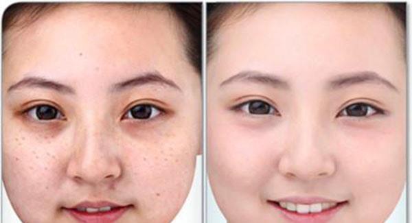 做<a href=http://www.mx185.com/listinfo-795-0.html target=_blank class=infotextkey>祛斑</a>副作用