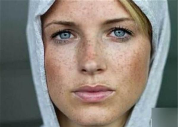 做E光<a href=http://www.mx185.com/listinfo-786-0.html target=_blank class=infotextkey>去黄褐斑</a>不适应人群有哪些