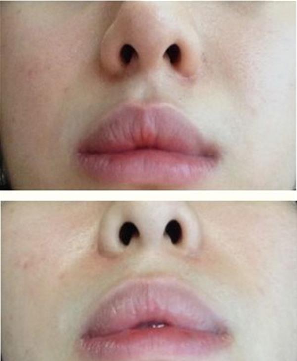 做<a href=http://www.mx185.com/listinfo-734-0.html target=_blank class=infotextkey>爱贝芙</a><a href=http://www.mx185.com/listinfo-797-0.html target=_blank class=infotextkey>去痘疤</a>风险有哪些