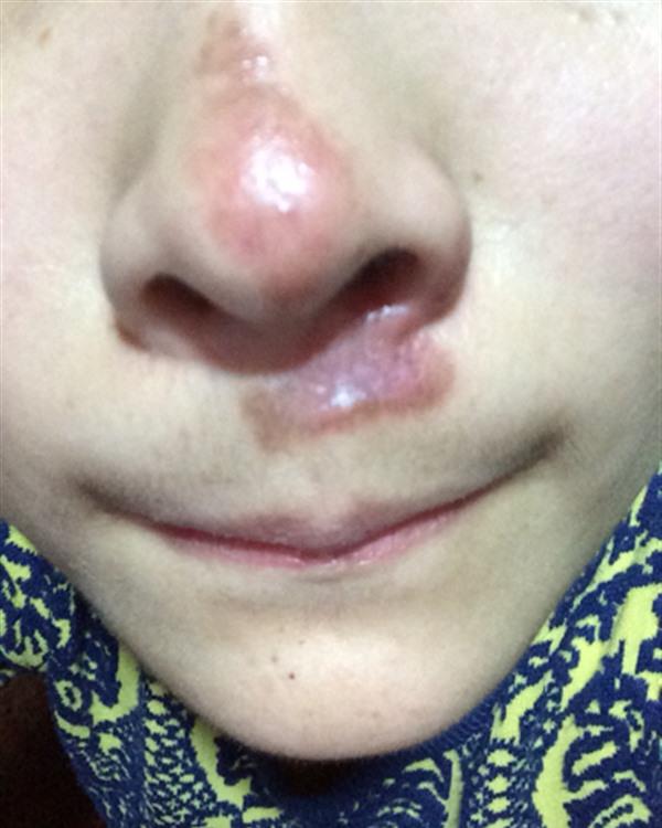 做疤痕增生修复效果好不好