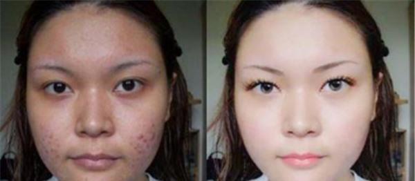 做激光<a href=http://www.mx185.com/listinfo-797-0.html target=_blank class=infotextkey>去痘疤</a>价格多少钱