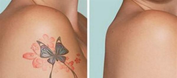 <a href=http://www.mx185.com/listinfo-793-0.html target=_blank class=infotextkey>洗纹身</a>疼吗多少钱一次