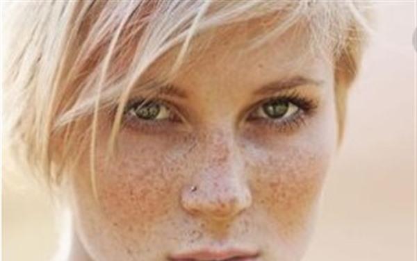 <a href=http://www.mx185.com/listinfo-786-0.html target=_blank class=infotextkey>去黄褐斑</a>费用