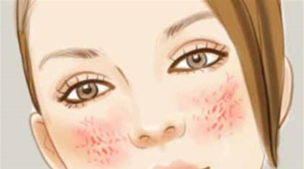 <a href=http://www.mx185.com/listinfo-772-0.html target=_blank class=infotextkey>去红血丝</a>手术的方法是什么？