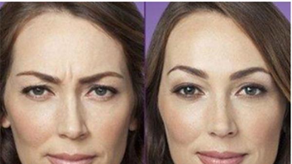 做<a href=http://www.mx185.com/listinfo-734-0.html target=_blank class=infotextkey>爱贝芙</a><a href=http://www.mx185.com/listinfo-771-0.html target=_blank class=infotextkey>去眉间纹</a>不适应人群有哪些