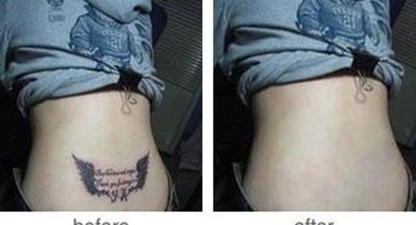 做激光<a href=http://www.mx185.com/listinfo-793-0.html target=_blank class=infotextkey>洗纹身</a>手术时间是多久?