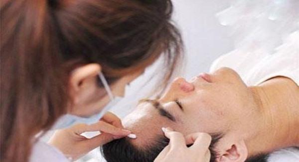 做针清祛痘手术时间是多久?