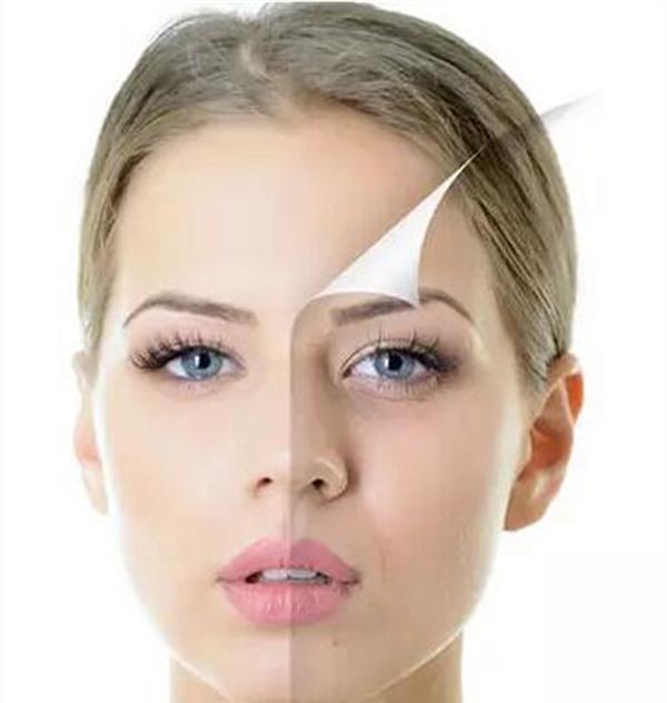 光子美白价格要多少?