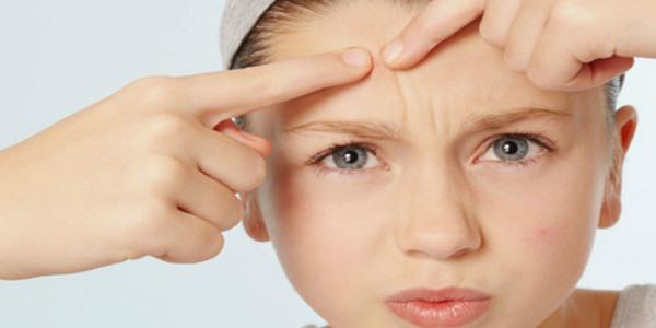 祛痘坑会留疤吗