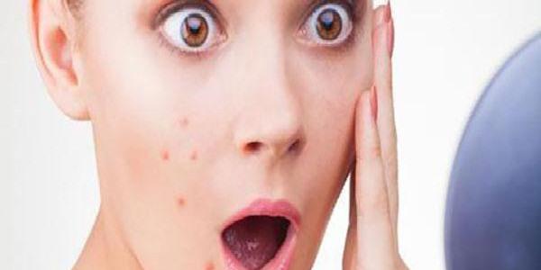 激光祛痘效果如何