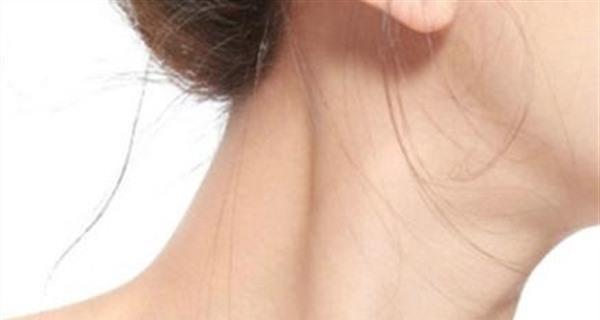 <a href=http://www.mx185.com/listinfo-785-0.html target=_blank class=infotextkey>去颈纹</a>手术价格