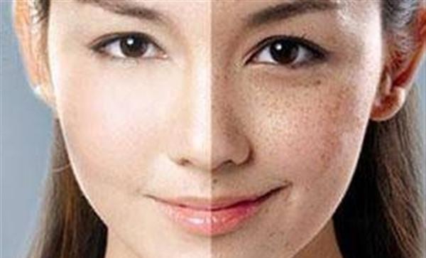 夏天有什么<a href=http://www.mx185.com/listinfo-795-0.html target=_blank class=infotextkey>祛斑</a>的方法