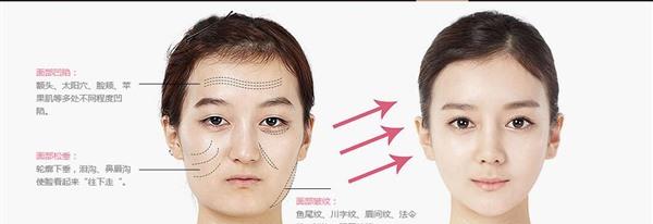 <a href=http://www.mx185.com/listinfo-764-0.html target=_blank class=infotextkey>面部年轻化</a>价格