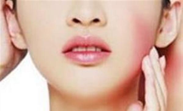 光子祛红血丝多少钱