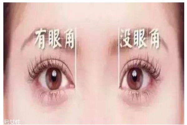 <a href=http://www.mx185.com/listinfo-711-0.html target=_blank class=infotextkey>开眼角</a>的好处是什么呢 <a href=http://www.mx185.com/listinfo-711-0.html target=_blank class=infotextkey>开眼角</a>需要注意什么呢