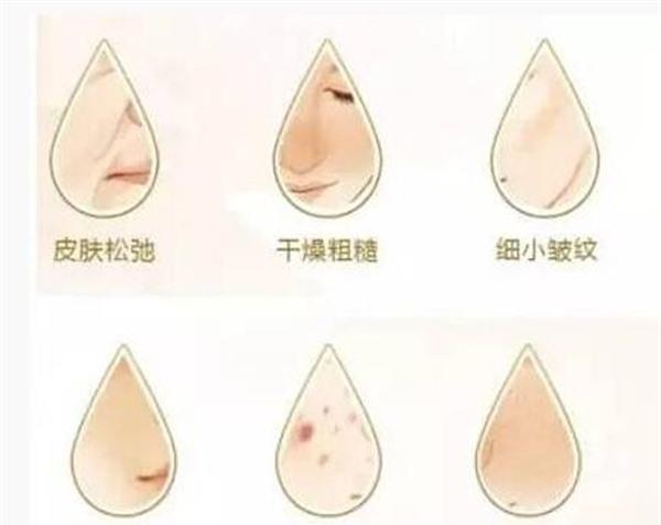 水光娃娃适应症状是什么？