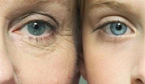 做激光除鱼尾纹风险有哪些