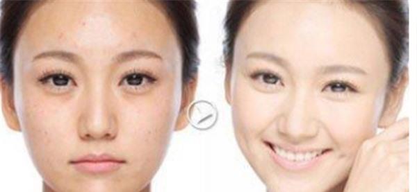 做化学剥脱<a href=http://www.mx185.com/listinfo-795-0.html target=_blank class=infotextkey>祛斑</a>不适应人群有哪些