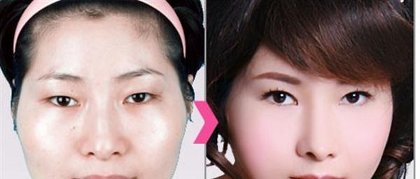 做E光<a href=http://www.mx185.com/listinfo-770-0.html target=_blank class=infotextkey>嫩肤</a>价格是多少