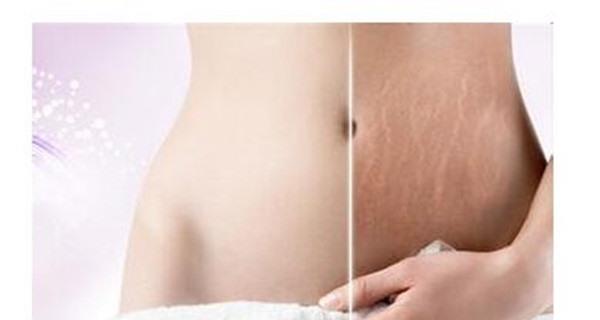 做像素激光需要注意什么