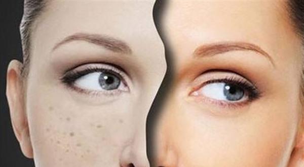 美白<a href=http://www.mx185.com/listinfo-795-0.html target=_blank class=infotextkey>祛斑</a>方法简介