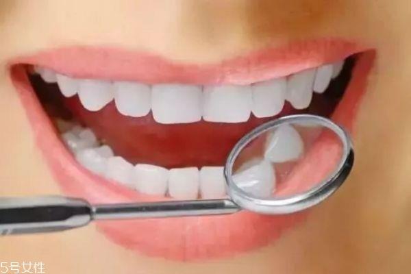 什么是支抗钉 打支抗钉有没有风险