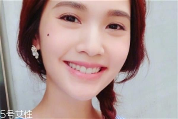 点痣能吃鱼吗 鱼属于发物