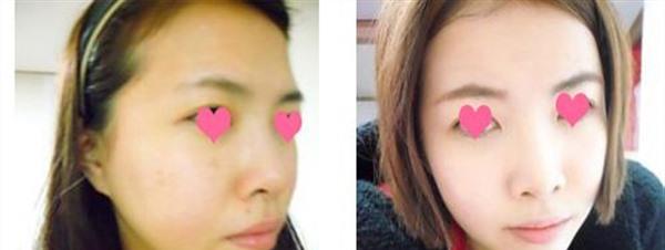 <a href=http://www.mx185.com/listinfo-768-0.html target=_blank class=infotextkey>微针</a><a href=http://www.mx185.com/listinfo-770-0.html target=_blank class=infotextkey>嫩肤</a>手术安全吗？