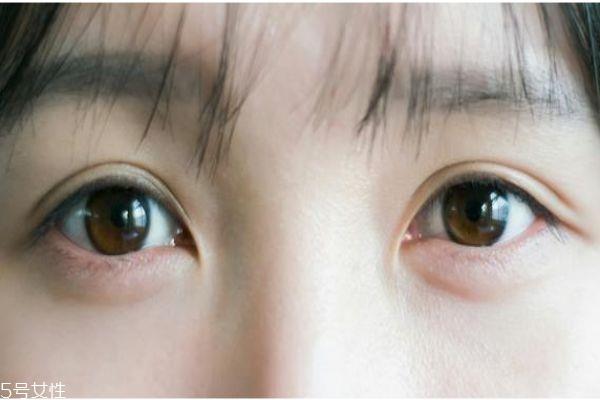 <a href=http://www.mx185.com/listinfo-705-0.html target=_blank class=infotextkey>美瞳线</a>有没必要纹 纹<a href=http://www.mx185.com/listinfo-705-0.html target=_blank class=infotextkey>美瞳线</a>注意事项
