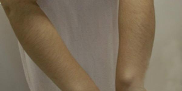 <a href=http://www.mx185.com/listinfo-783-0.html target=_blank class=infotextkey>祛疤</a>多长时间恢复