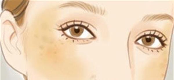 做<a href=http://www.mx185.com/listinfo-786-0.html target=_blank class=infotextkey>去黄褐斑</a>有哪些风险