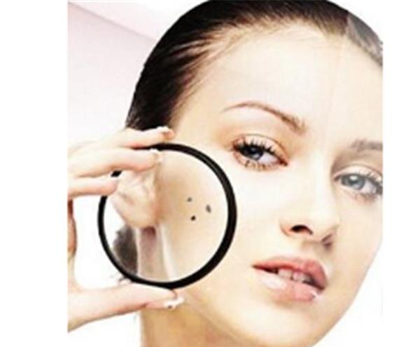 做微晶磨削点痣不适应人群有哪些