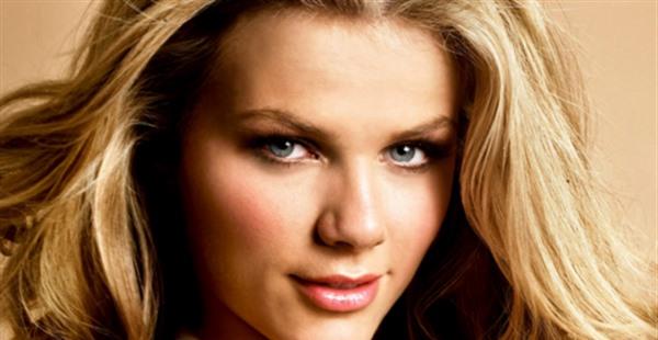 激光祛除雀斑多少钱