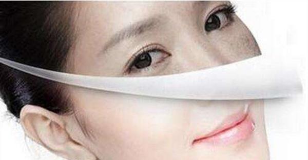 做E光<a href=http://www.mx185.com/listinfo-786-0.html target=_blank class=infotextkey>去黄褐斑</a>风险有哪些