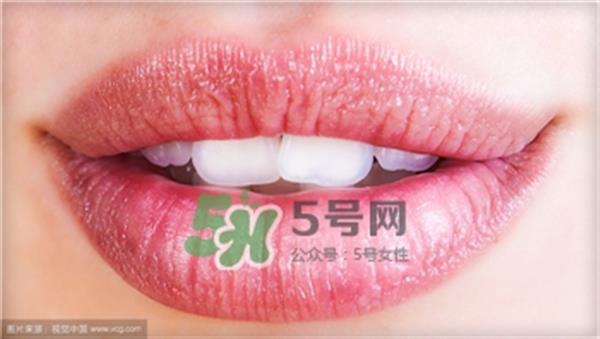洗牙之后多久可以吃东西?洗牙之后吃什么?