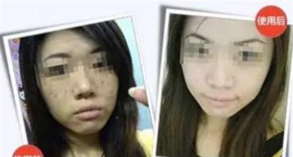 做彩光<a href=http://www.mx185.com/listinfo-770-0.html target=_blank class=infotextkey>嫩肤</a>有副作用吗