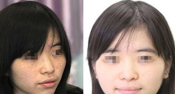 做彩光<a href=http://www.mx185.com/listinfo-795-0.html target=_blank class=infotextkey>祛斑</a>副作用是什么