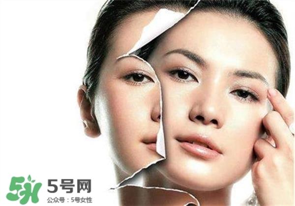 美白养护是什么？美白养护可以连续打吗？