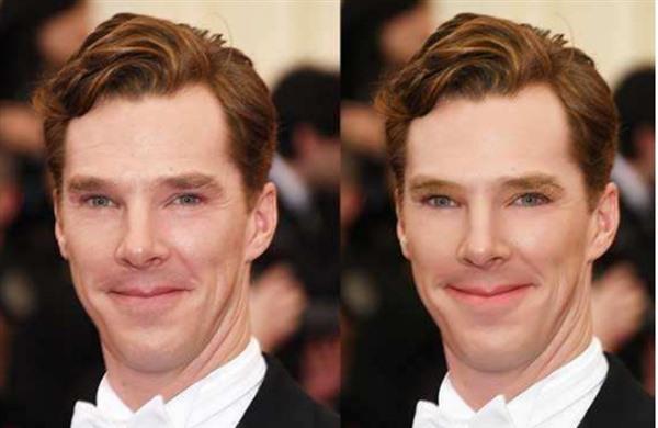 做自体脂肪<a href=http://www.mx185.com/listinfo-782-0.html target=_blank class=infotextkey>去眼角细纹</a>治疗效果怎么样?效果保持时间多久?