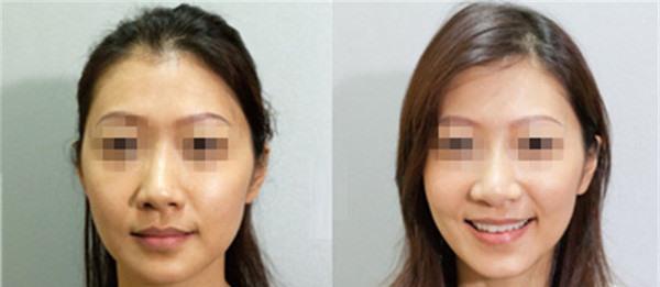 做果酸<a href=http://www.mx185.com/listinfo-770-0.html target=_blank class=infotextkey>嫩肤</a>价格