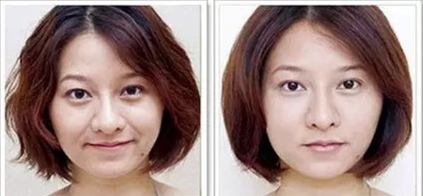 <a href=http://www.mx185.com/listinfo-734-0.html target=_blank class=infotextkey>爱贝芙</a><a href=http://www.mx185.com/listinfo-792-0.html target=_blank class=infotextkey>去法令纹</a>适应症状是什么?