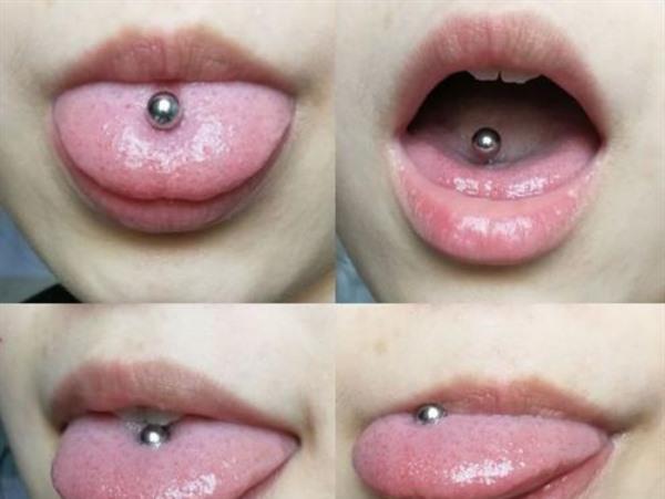 舌钉发炎了怎么办 舌钉怎么护理
